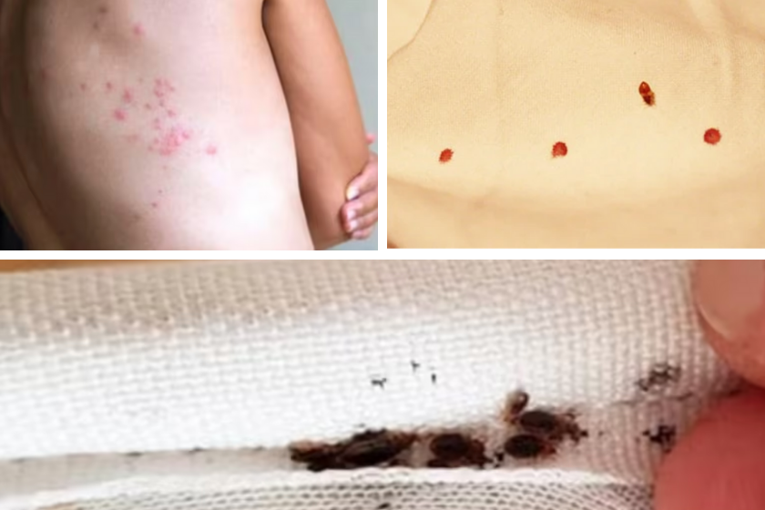 Comment savoir si on a des punaises de lit chez soi.png